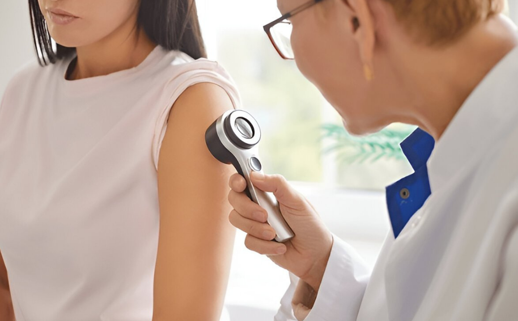 Skin cancer